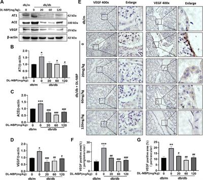 Dl-3-n-Butylphthalide Ameliorates Diabetic Nephropathy by Ameliorating Excessive Fibrosis and Podocyte Apoptosis